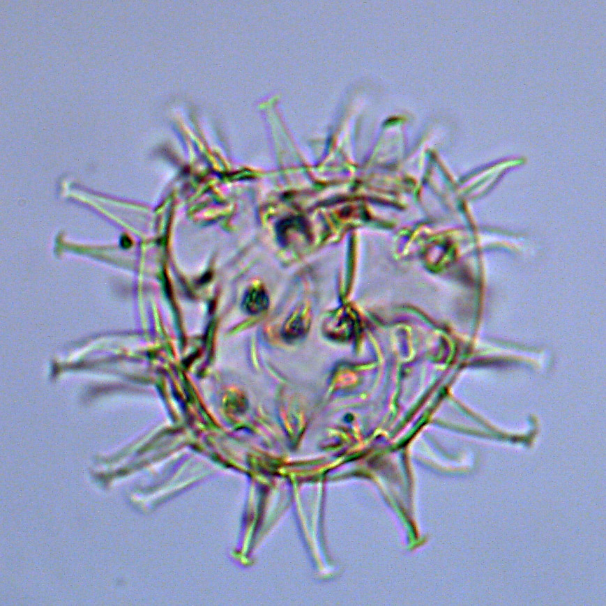 Dapsilidinium, U1581-27R-2W, 130-134, sl. 1, O16-2.4, foto-b.jpg